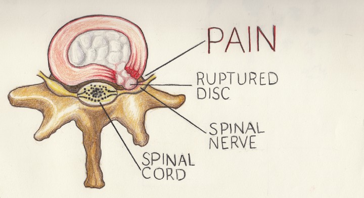 MY JOURNEY INTO THE WORLD OF PAIN